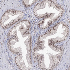 Immunohistochemical staining of human prostate shows moderate nuclear positivity in glandular cells.