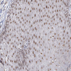 Immunohistochemical staining of human skin shows moderate nuclear positivity in squamous epithelial cells.