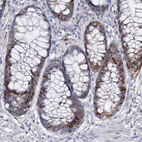 Anti-FAM111B Antibody