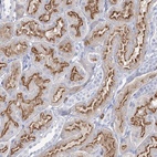 Anti-CCDC73 Antibody