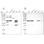 Anti-IKBIP Antibody