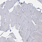 Immunohistochemical staining of human skeletal muscle shows no positivity in myocytes as expected.