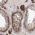 Anti-LRRC56 Antibody