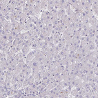 Immunohistochemical staining of human liver shows no positivity in hepatocytes as expected.