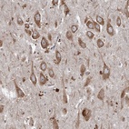 Anti-SRPX2 Antibody