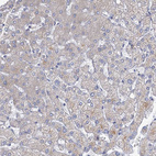 Anti-PRSS35 Antibody