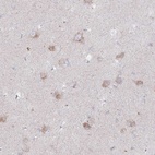 Immunohistochemical staining of human lateral ventricle shows cytoplasmic positivity in neurons.