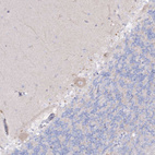 Immunohistochemical immunoreactivity shows weak cytoplasmic positivity in Purkinje cells.