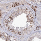 Immunohistochemical staining of human testis shows strong cytoplasmic positivity in seminiferus ducts and leydig cells.