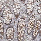 Anti-SLC39A8 Antibody