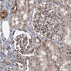 Anti-RASSF4 Antibody