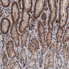 Anti-RASSF4 Antibody