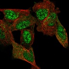 Anti-C11orf96 Antibody