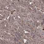 Anti-GRIP1 Antibody