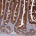 Anti-C12orf73 Antibody