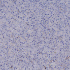 Anti-C12orf73 Antibody