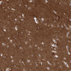 Anti-PACS1 Antibody