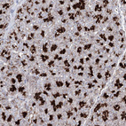 Anti-C11orf80 Antibody