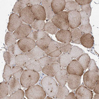 Anti-C11orf80 Antibody