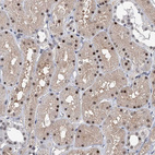 Immunohistochemical staining of human kidney shows moderate nuclear positivity in cells in tubules.