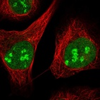 Immunofluorescent staining of human cell line U-2 OS shows localization to nucleus & nucleoli.