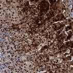 Anti-MBD6 Antibody