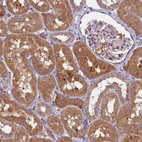 Anti-ETFBKMT Antibody