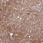 Anti-ETFBKMT Antibody