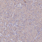 Anti-ETFBKMT Antibody