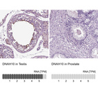 Anti-DNAH10 Antibody