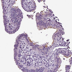 Anti-DNAH10 Antibody