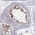 Immunohistochemical staining of human testis shows high expression.