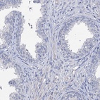 Immunohistochemical staining of human prostate shows low expression as expected.