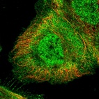 Anti-ZDBF2 Antibody