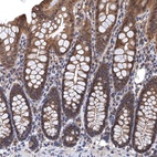 Anti-LRRC2 Antibody