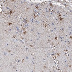 Anti-KLHL32 Antibody