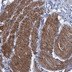 Anti-ESYT3 Antibody