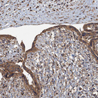 Anti-SDS Antibody