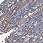 Anti-IFITM5 Antibody