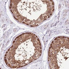 Anti-STIP1 Antibody