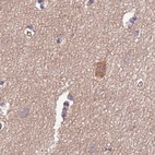 Anti-STIP1 Antibody