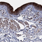 Anti-DEPDC4 Antibody