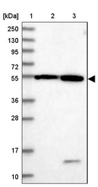 Anti-DEPDC4 Antibody