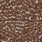 Anti-N4BP2L2 Antibody