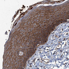 Anti-N4BP2L2 Antibody