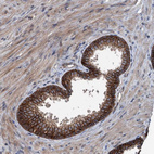 Anti-N4BP2L2 Antibody