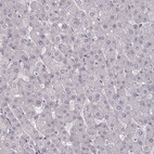 Anti-PRLHR Antibody