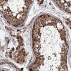 Anti-CEP192 Antibody