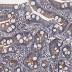 Anti-RASSF9 Antibody