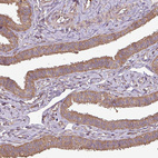 Anti-PLEKHM1 Antibody